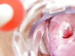 Dubļains medmāsa saņem solo